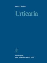 Urticaria