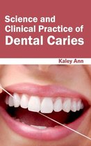 Science and Clinical Practice of Dental Caries