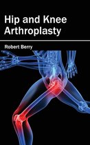 Hip and Knee Arthroplasty