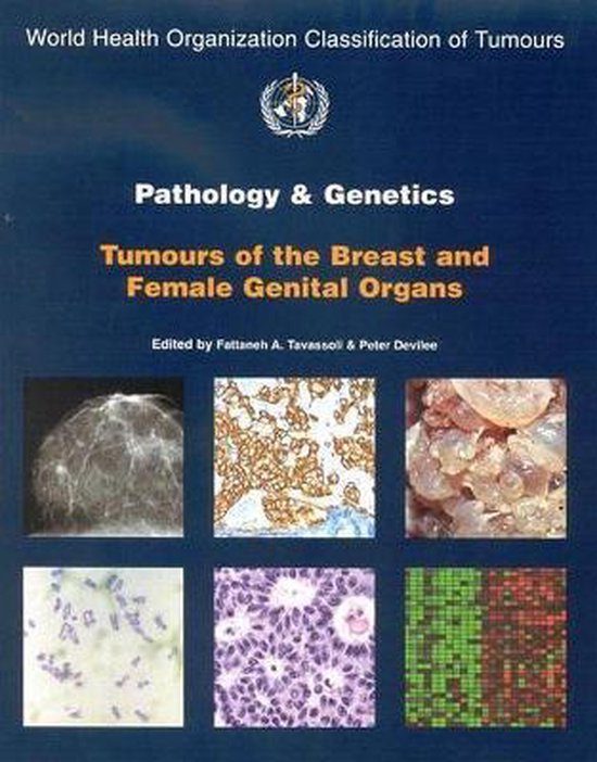 Pathology And Genetics Of Tumours Of The Breast And Female Genital