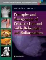 Foot Deformities & Malformations In Chil