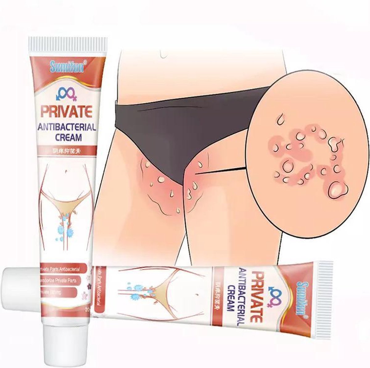 Goedkoopste Antibacteriële Jeuk Crème | Jeuk/Geur Zalf | Dermatitis Zalf Voor Mannen en Vrouwen - 2 tubes