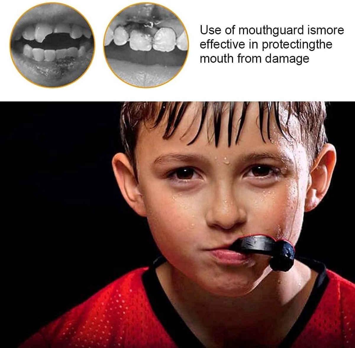 JUVEL Professional Sports Mouth Guard - Mouth Guard with Transparent Cover, Improved Air Ducts, Comfort and Secure - ShopVlot