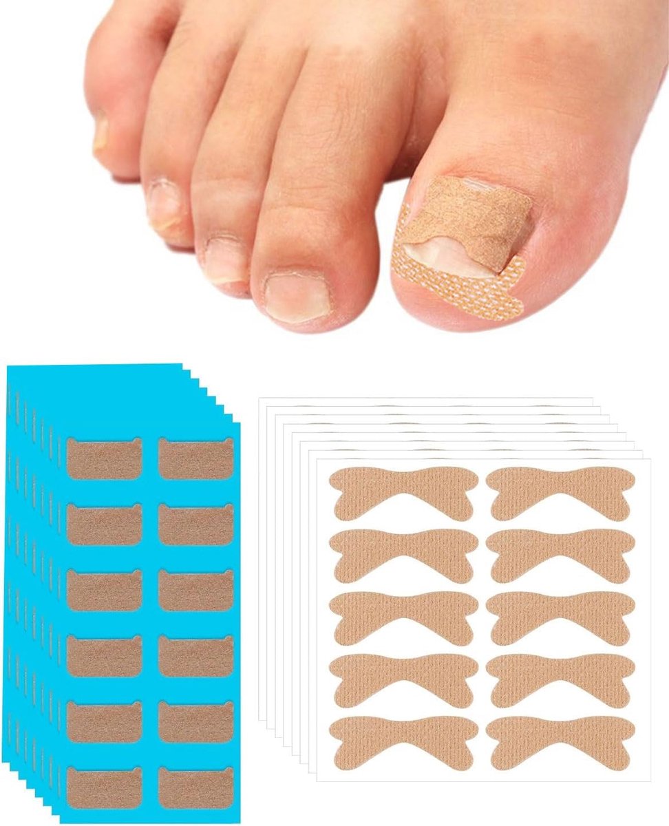 176-delige correctieset voor ingegroeide teennagels, ademende pleisters en correctiestickers met professioneel - ShopVlot