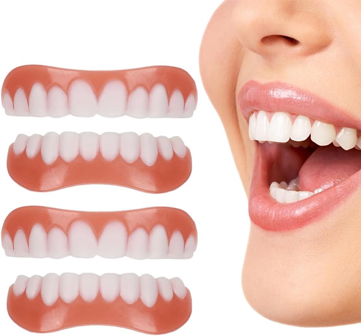 Set of 2 Adhesive Dental Prostheses, Universal Temporary Veneers for Upper and Lower Jaw, for Imperfect Teeth, with - ShopVlot
