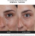 Voor-en-na foto's van een gezicht met rond de ogen. Behandeld met Paula's Choice C5 Super Boost Moisturizer. Tekst: 'BRIGHTEN + HYDRATE', 'BEFORE', 'AFTER 8 WEEKS'.