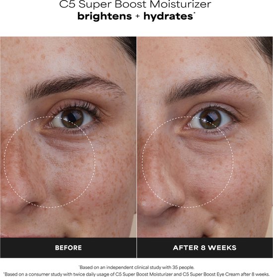 Voor-en-na foto's van een gezicht met rond de ogen. Behandeld met Paula's Choice C5 Super Boost Moisturizer. Tekst: 'BRIGHTEN + HYDRATE', 'BEFORE', 'AFTER 8 WEEKS'.