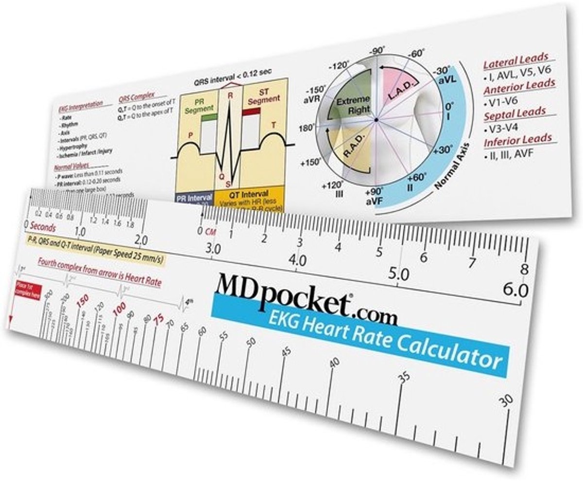 ECG Hartslagmeter en Interval Liniaal voor Hartritme Analyse