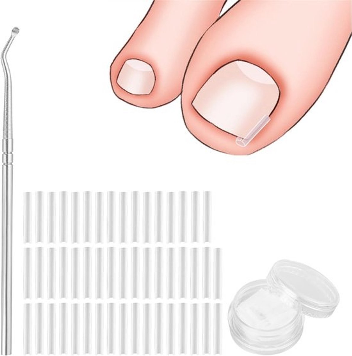 Nagelverzorgingsset - Nagelcorrectie Tools - Ingegroeide Nagel Hulp - 51 Delige Set - 13.1 x 7.5 x 1.8 cm