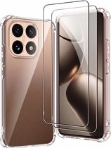 Coque et verre Casemania compatibles avec Xiaomi 17T Pro - Transparent - Coque arrière antichoc + 2x protecteurs d'écran en verre