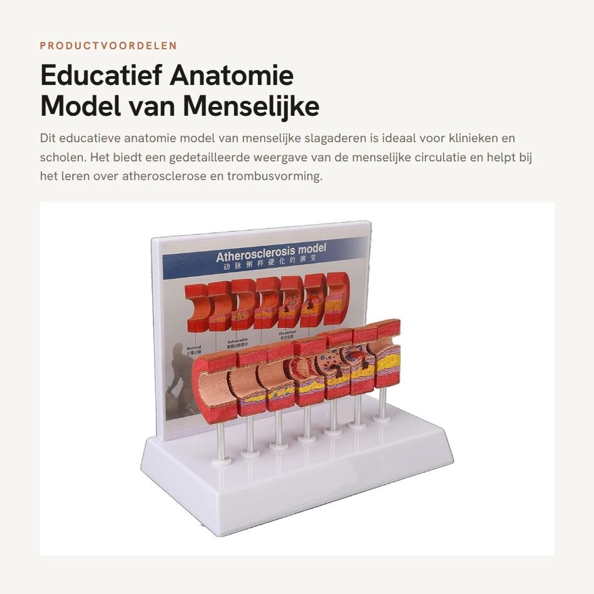 Solidchoice- Slagader Model 7 Stuks - Anatomie Model - Educatief Hulpmiddel - PVC Materiaal - Communicatiemiddel Arts/Patiënt - Veilig en Betrouwbaar - Anatomiemodel