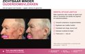 Twee afbeeldingen van Mark (87): links 'voor' met ouderdomsvlekken, rechts 'na' met een egalere huid.