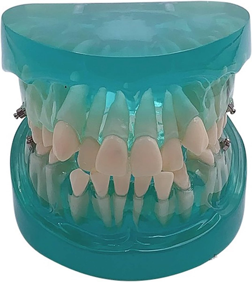 Tanden Model - Tandarts Model - Onderwijs Studie - Met Beugels - 1 Gram - Blauw