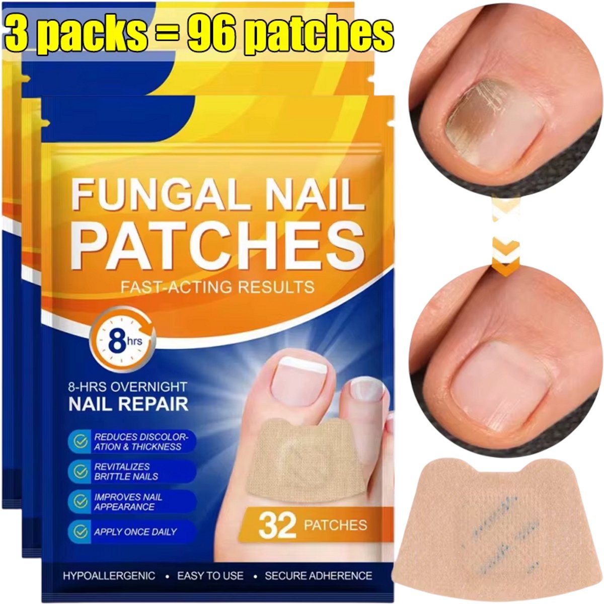 Teennagel Correctie Pleisters 96 Stuks – Zelfklevende Nagelcorrectie Strips, Ingegroeide Teennagel Hulpmiddel, Onzichtbare Voetverzorging en Pedicure Accessoire