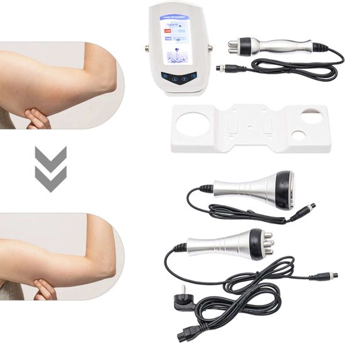 Ultrasone Cavitatie Afslankmachine Wit - 50W Vermogen - 100-240V AC Stroomvoorziening - ABS Materiaal - Lichaamsmassageapparaat