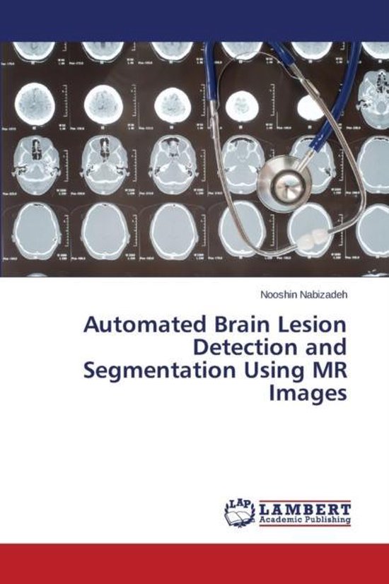 Automated Brain Lesion Detection and Segmentation Using MR I ... - cover
