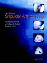 Atlas of Shoulder Arthroscopy