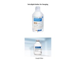 Intralipid-Iodine for Imaging