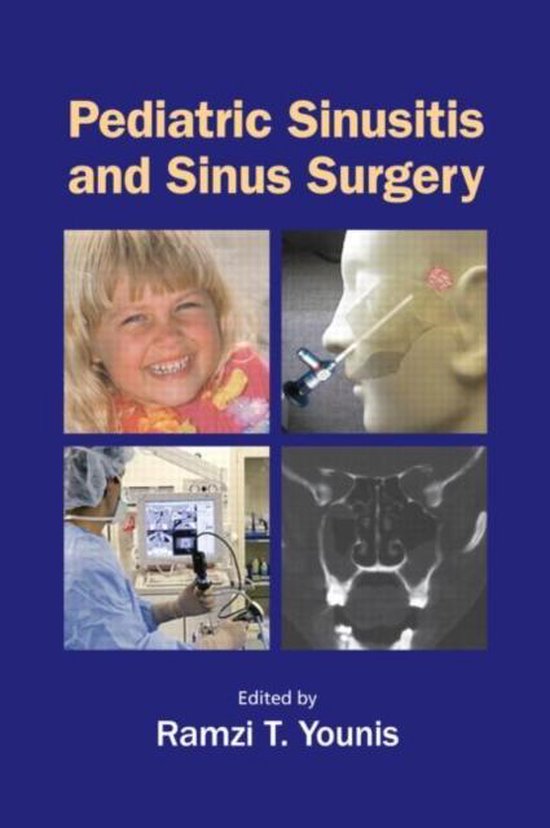 Pediatric Sinusitis and Sinus Surgery - cover
