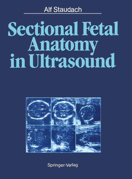 Medicine (R0) - Sectional Fetal Anatomy in Ultrasound - cover