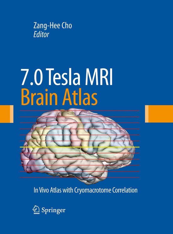 7.0 Tesla MRI Brain Atlas - cover