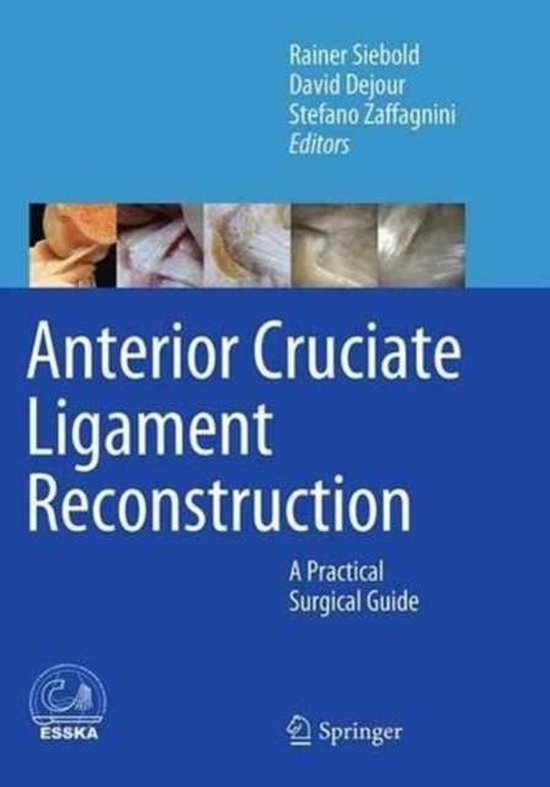 Anterior Cruciate Ligament Reconstruction - cover