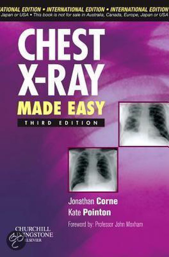 Chest XRay Made Easy 9780443067358 Boeken bol