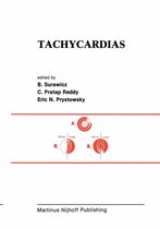 Developments in Cardiovascular Medicine 28 - Tachycardias