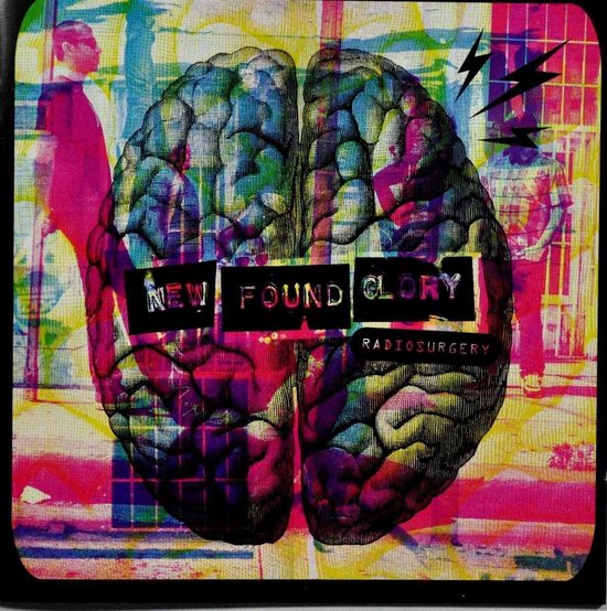 Radiosurgery
