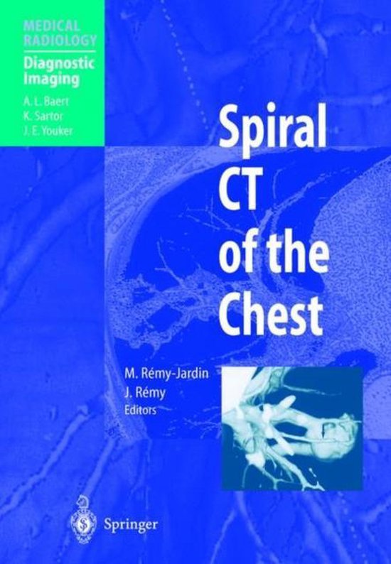 Spiral CT of the Chest - cover