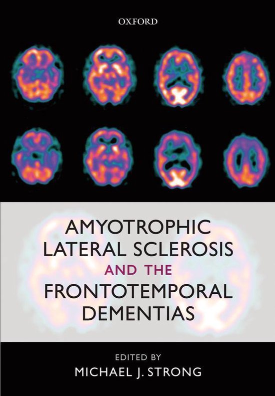 Amyotrophic Lateral Sclerosis and the Frontotemporal Dementi ... - cover