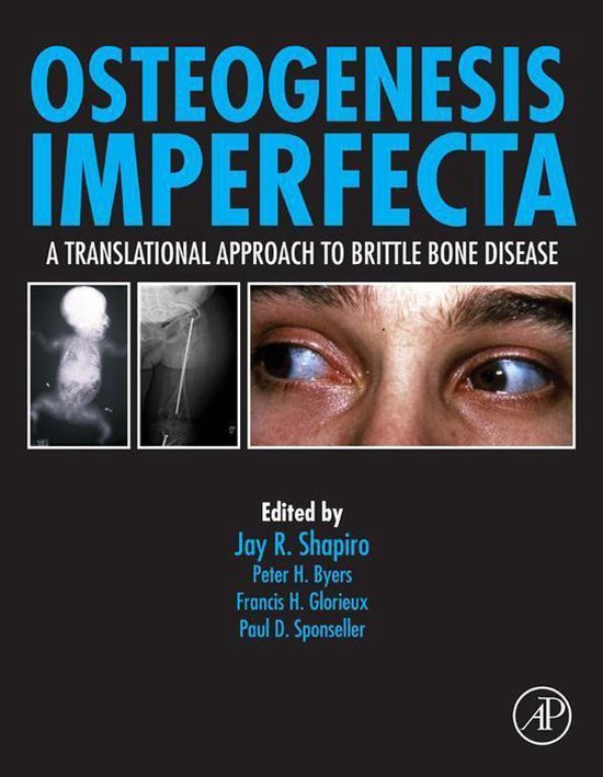 Osteogenesis Imperfecta - cover