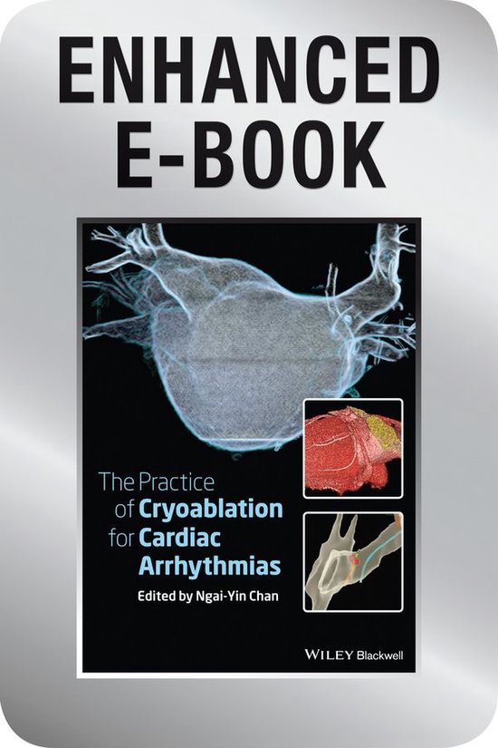 The Practice of Catheter Cryoablation for Cardiac Arrhythmia ... - cover