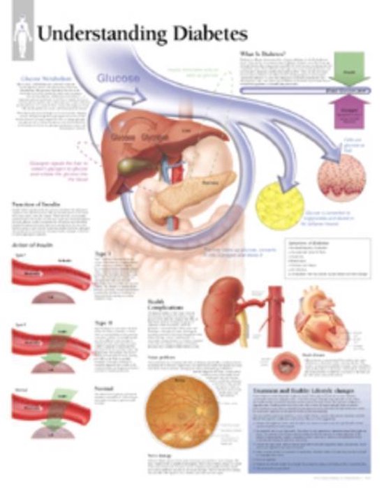 Foto: Understanding diabetes laminated poster