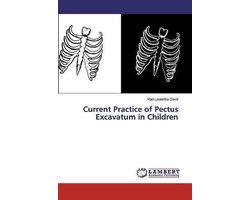 Current Practice of Pectus Excavatum in Children