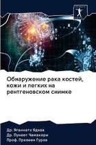 Обнаружение рака костей, кожи и легких на р
