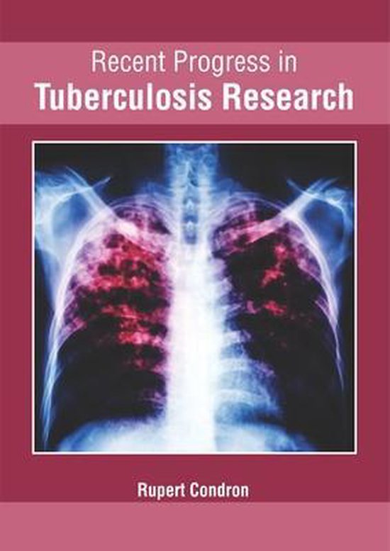 recent research topics in tuberculosis