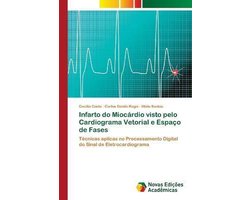 Infarto do Miocárdio visto pelo Cardiograma Vetorial e Espaço de Fases