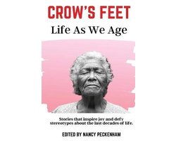 Crow's Feet