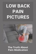 Low Back Pain Pictures: The Truth About Pain Medication