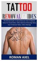 Tattoo Removal Guide: The Ultimate Guide To Tattoo Removal