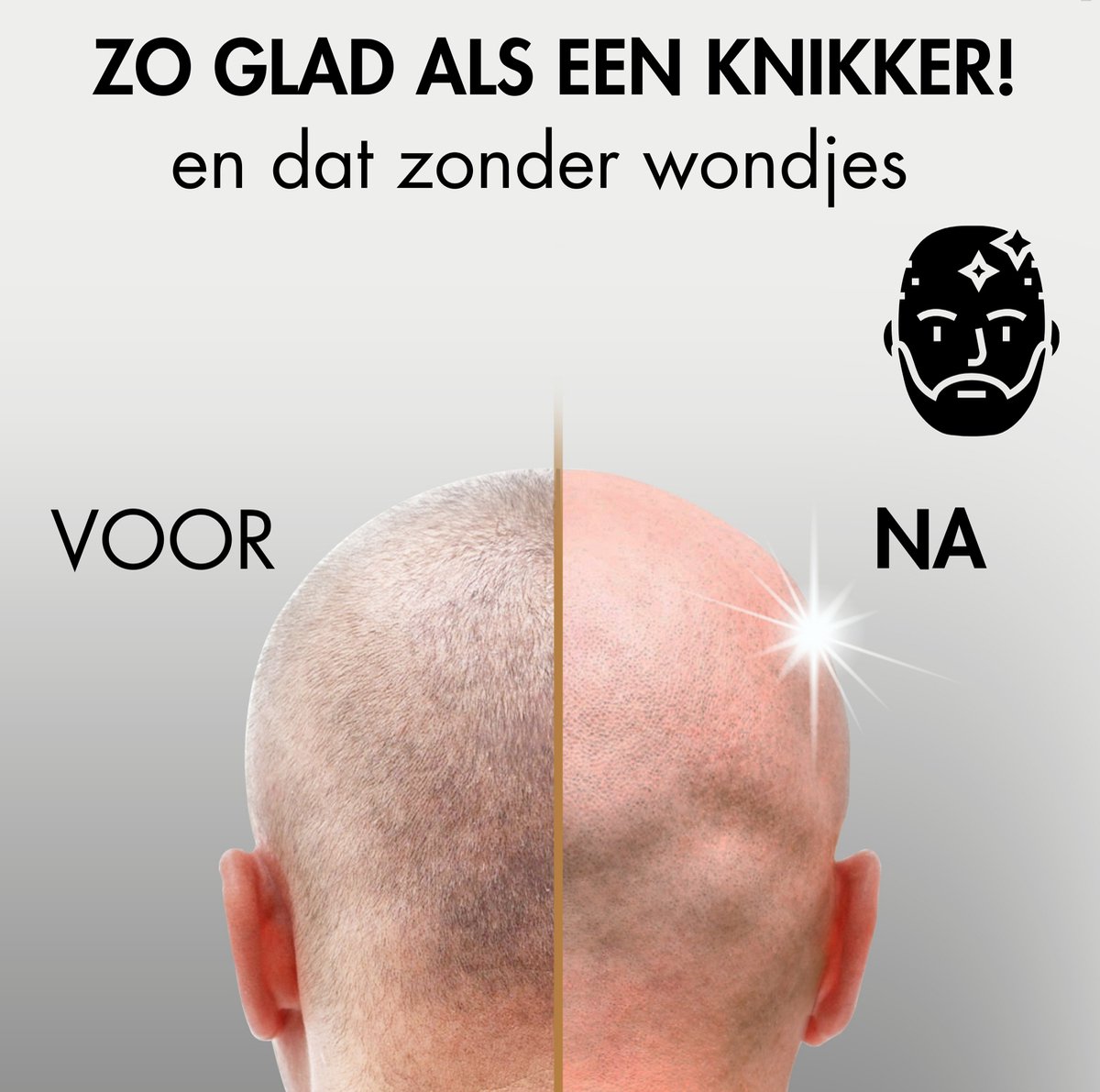 6-in-1 Scheerapparaat Mannen – Trimmer - Tondeuse - Sansbeauté® Skull Sharp PRO MAGNETIC - Electric Face & Head Shaver - Shave - Hoofd Kaal Scheren – Nat & Droog - Draadloos Opladen - Elektrisch thumbnail 2