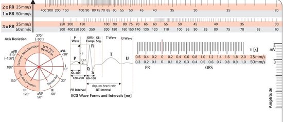 The Medical Lounge. Transparante ECG-liniaal/kaart met toegang tot ECG-cursus. Volg een 7 stappenplan, Zakformaat 8,6 cm x 5,4 cm Ideaal voor studenten, paramedici, EMT's, verpleegkundigen en