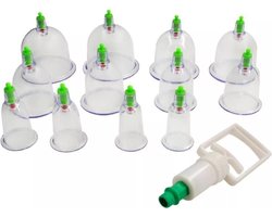 Soulima 20-delige Vacuum Cupping Set – 6 Formaten Vacuum Cups & Pull-Out Cupping Pomp - Anti-Cellulitis Therapie & Chinese Massage - Effectief Vacuüm Cupping Apparaat voor Thuis