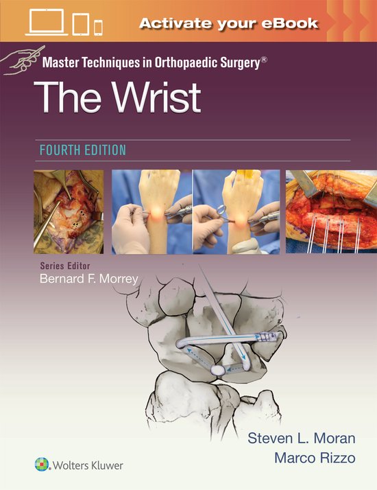 Master Techniques in Orthopaedic Surgery- Master Techniques  ... - cover