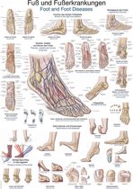 Het menselijk lichaam - anatomie poster voet en voetaandoeningen (Duits/Engels/Latijn, papier, 50x70 cm) + ophangsysteem