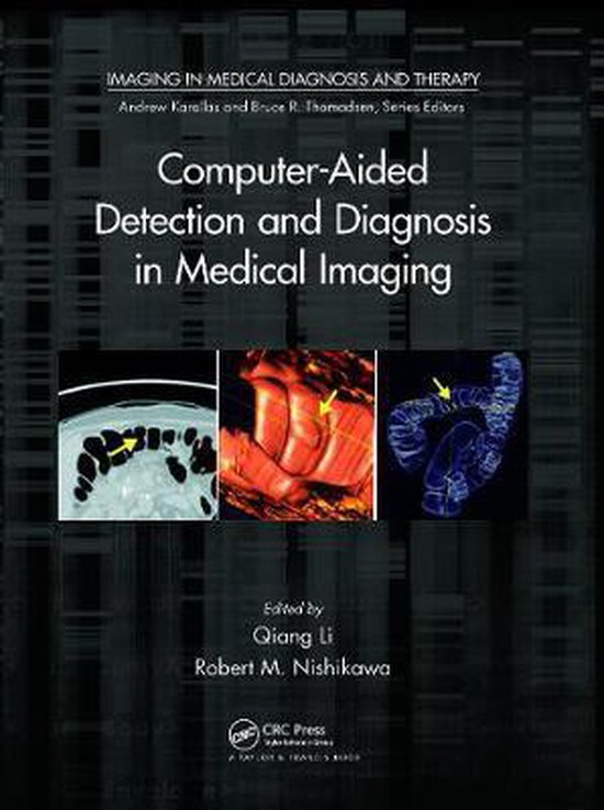 Foto: Imaging in medical diagnosis and therapy computer aided detection and diagnosis in medical imaging