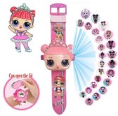 LOL Surprise horloge - L.O.L. Surprise projector horloge - Digitale  LOL Surprise horloge - Speelgoed horloge LOL - kinder horloge