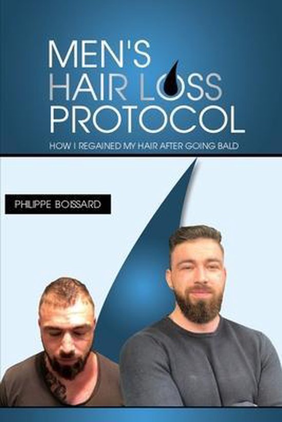Men's hairloss protocol - cover