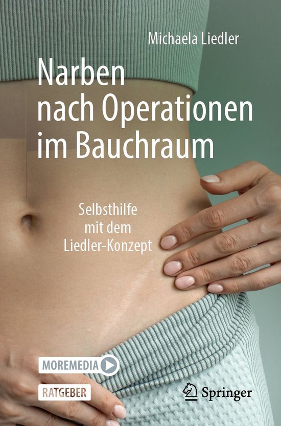 Medicine (German Language) - Narben nach Operationen im Bauc ... - cover